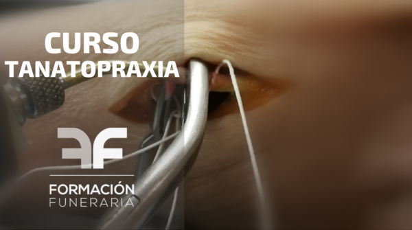 Tanatopraxia